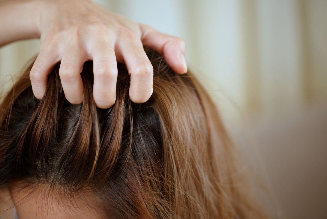 Scalp Dermatitis: Causes & Solutions for Healthier Hair  MooGoo AU