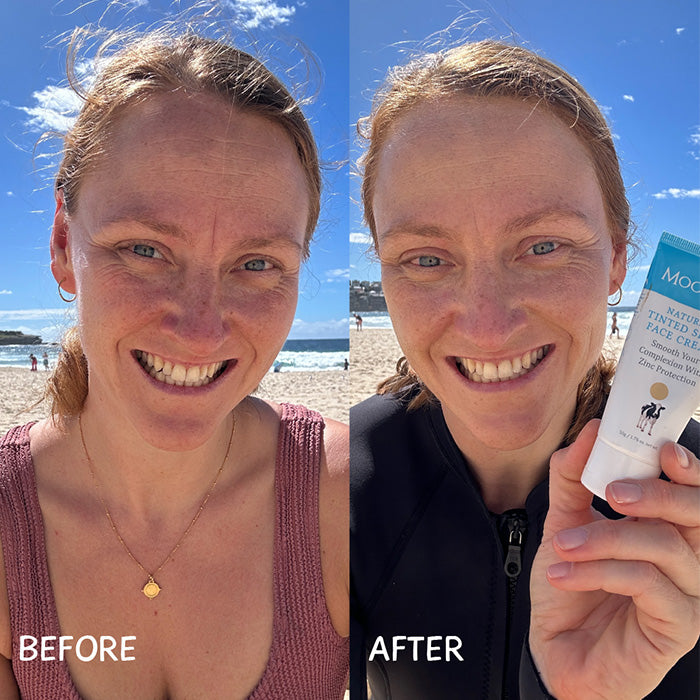 hydrates and reduces redness in sensitive skin.
MooGoo Tinted SPF 40 Face Cream at beach before and after, zinc oxide sunscreen with tint for dewy coverage, UVA UVB protection and skin hydration.