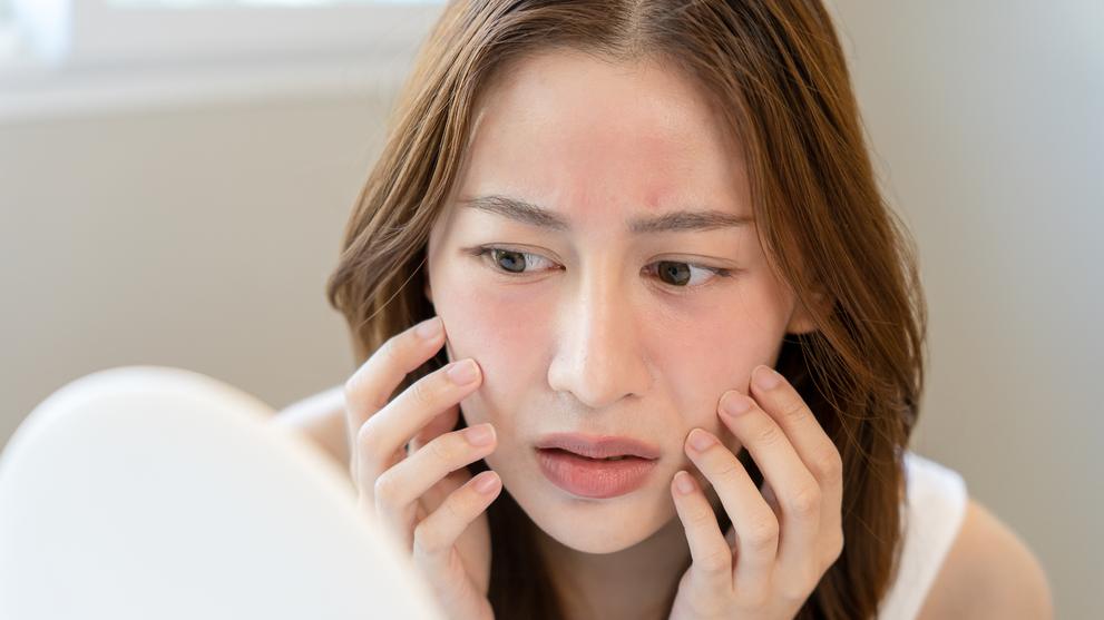 Natural Alternatives to Retinol