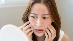 Natural Alternatives to Retinol
