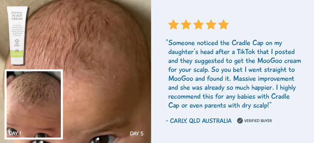 Scalp Cream