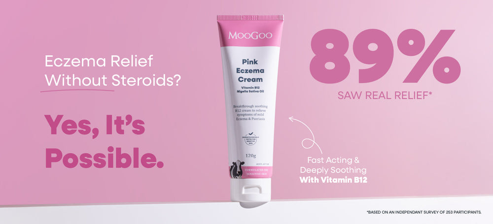 Eczema Cream