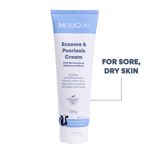 Eczema & Psoriasis Cream with Marshmallow, Elderberry & More
