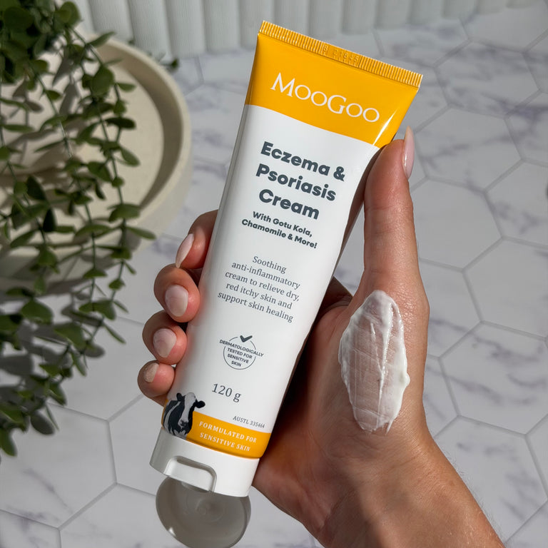 Hand holding MooGoo Eczema & Psoriasis Cream Yellow Label with cream on hand and white tiles and greenery in the background