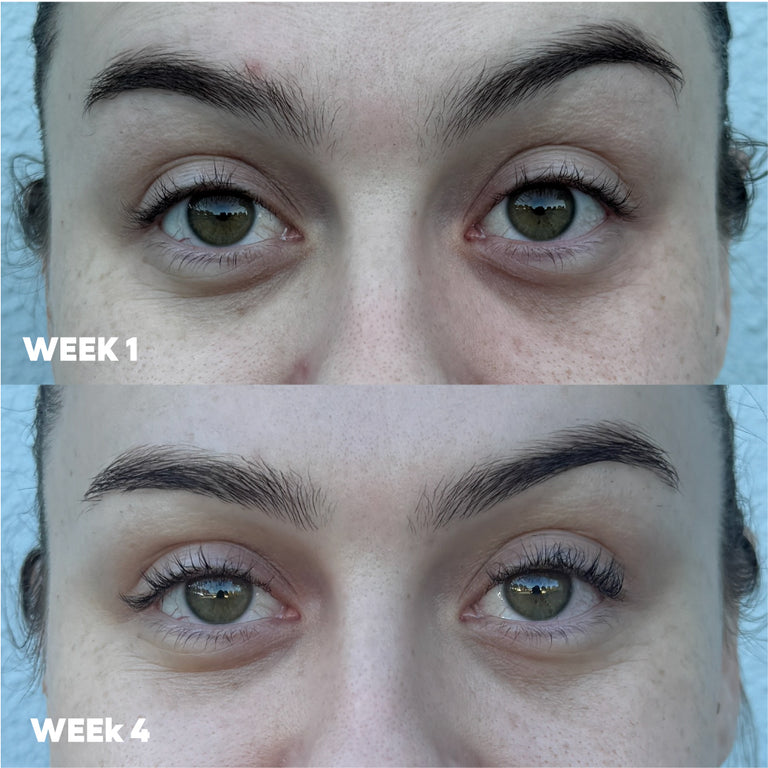 MooGoo 3-in-1 Peptide Eye Serum before & after of a female. Made with Vitamin C, Copper Tri-Peptide, Argireline Amplified and Vitamin K to brighten dark circles, reduce fine lines and wrinkles, and diminish under eye puffiness.
