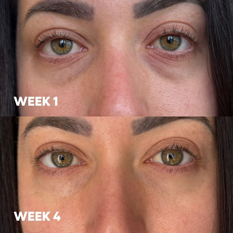 A close-up before-and-after comparison of a woman's eyes, with the top panel labeled WEEK 1 and the bottom panel labeled WEEK 4. The image shows visible under-eye darkness and fine lines in the top panel and a smoother, brighter appearance in the bottom panel.