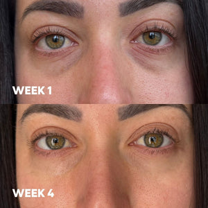 A close-up before-and-after comparison of a woman's eyes, with the top panel labeled WEEK 1 and the bottom panel labeled WEEK 4. The image shows visible under-eye darkness and fine lines in the top panel and a smoother, brighter appearance in the bottom panel.