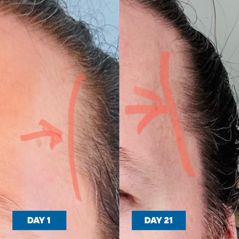Hair Growth Serum
