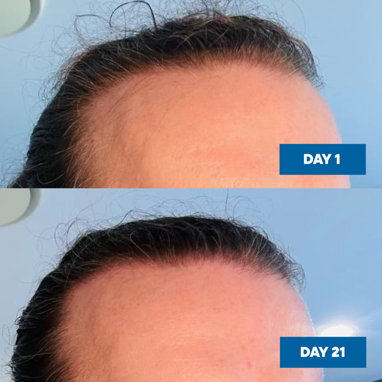 Hair Growth Serum