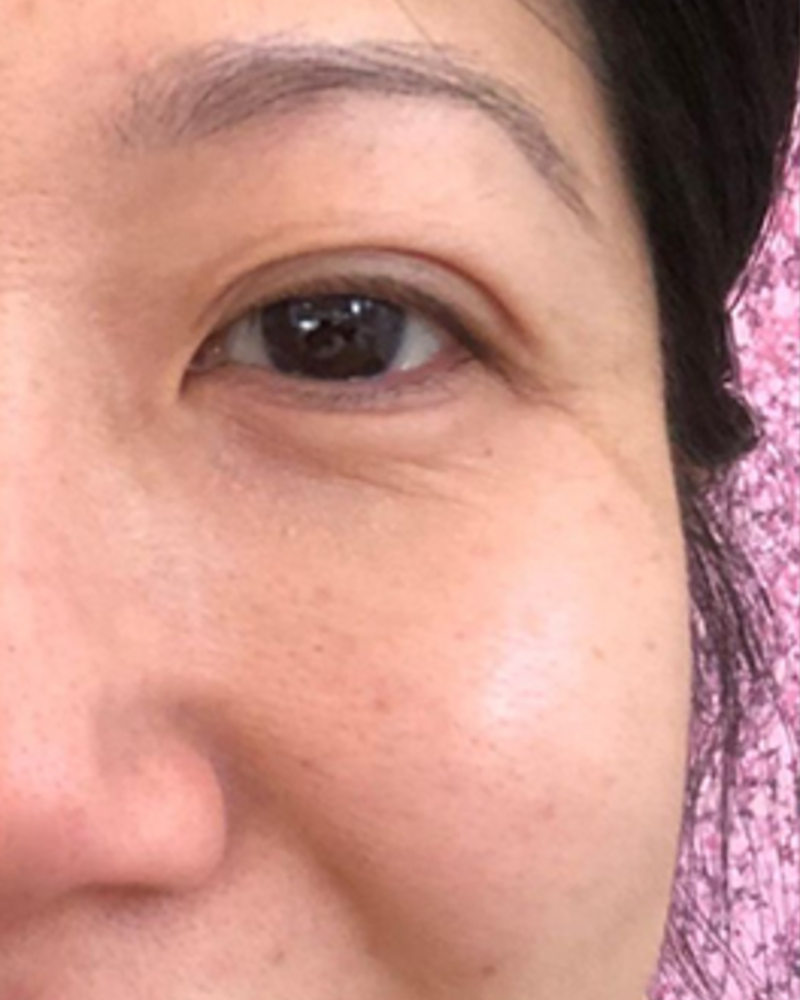 Before using Argireline Amplified Peptide Serum