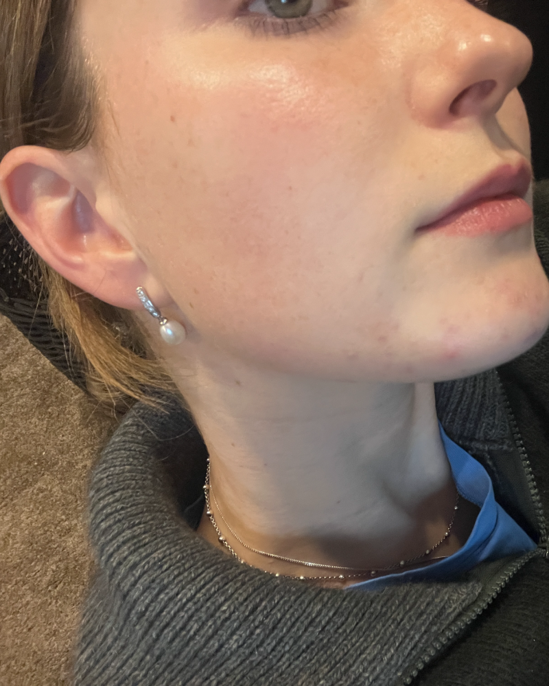 After using Gentle Foaming Face Cleanser