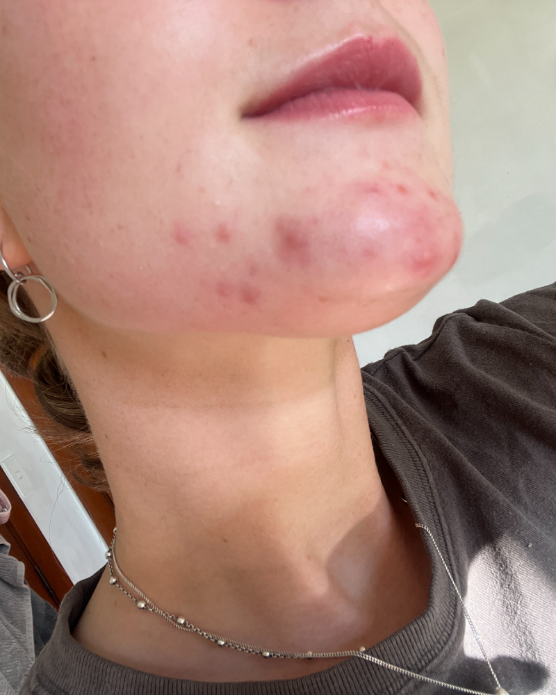 Before using Gentle Foaming Face Cleanser