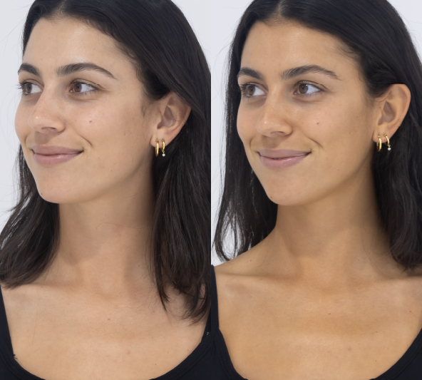 Customer side view before and 24 hours after MooGoo Tanning Face Mist