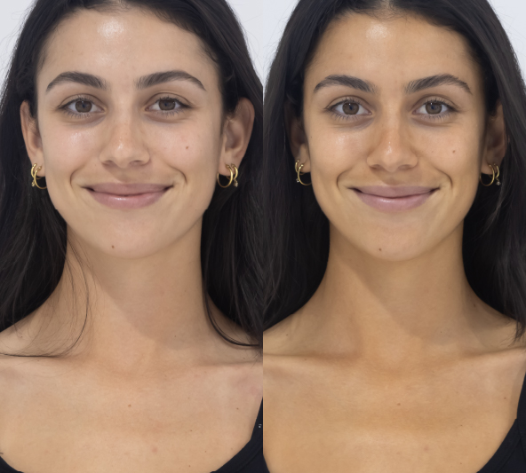 Smiling customer before and 24 hours after one application of MooGoo Tanning Face Mist