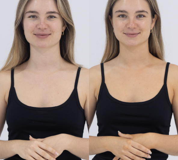 Customer before and 24 hours after one application of MooGoo Tanning Water