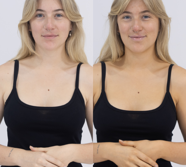 Before and after 24 hours using Tanning Water